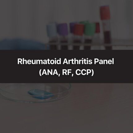 Rheumatoid Arthritis Panel (ANA, RF, CCP)