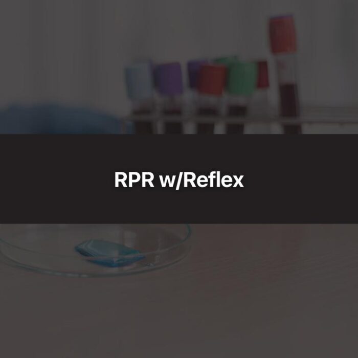 RPR w/Reflex