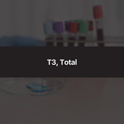 T3, Total
