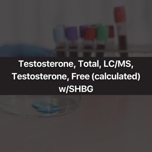 Testosterone, Total, LC/MS, Testosterone, Free (calculated) w/SHBG