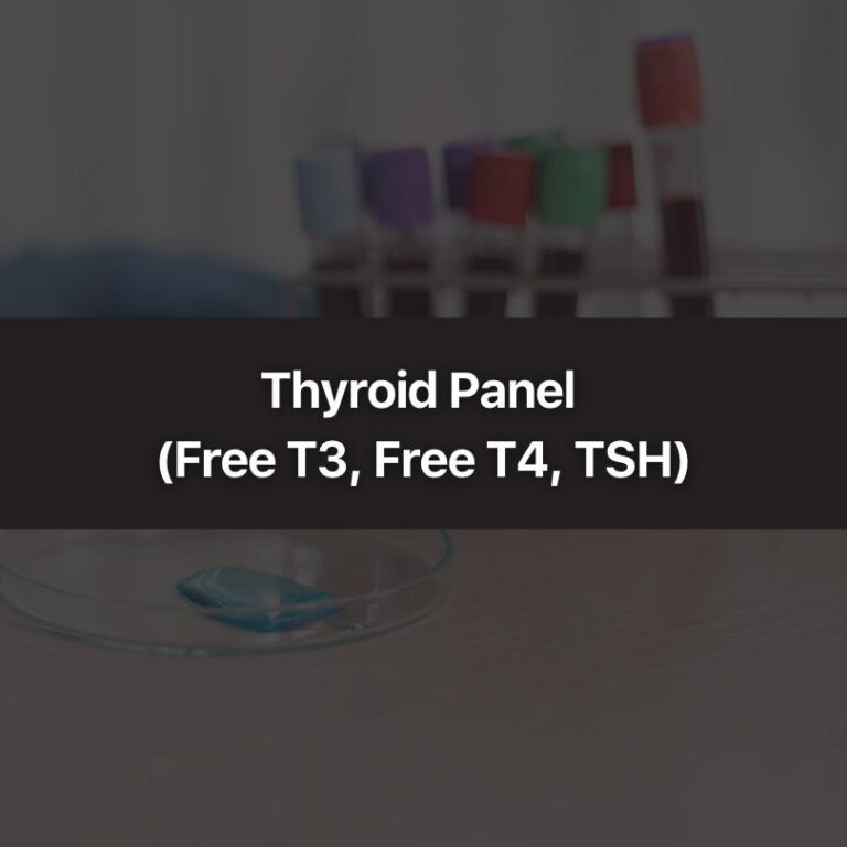 Thyroid Panel (Free T3, Free T4, TSH)