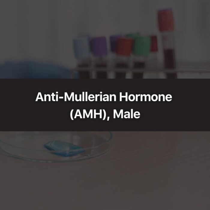 Anti-Mullerian Hormone (AMH), Male