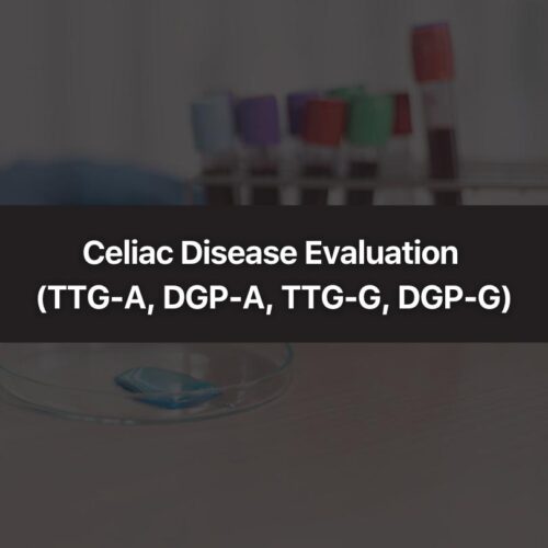 Celiac Disease Evaluation (TTG-A, DGP-A, TTG-G, DGP-G)