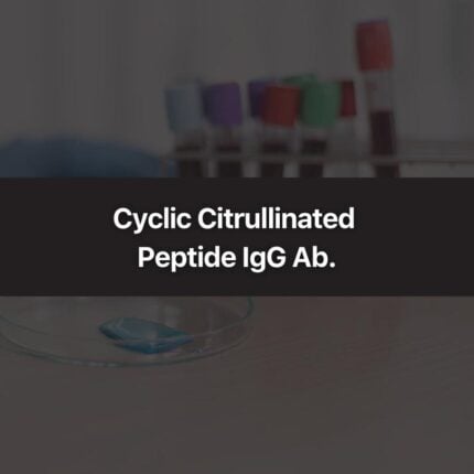 Cyclic Citrullinated Peptide IgG Ab.