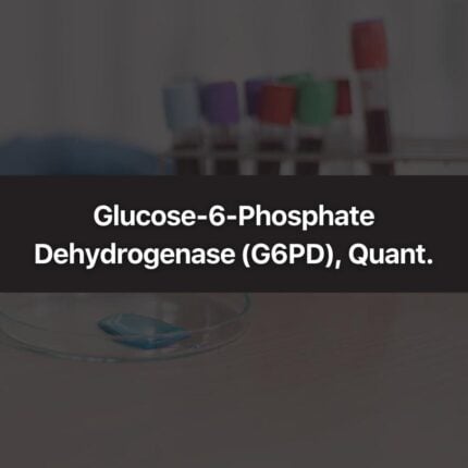 Glucose-6-Phosphate Dehydrogenase (G6PD), Quant.