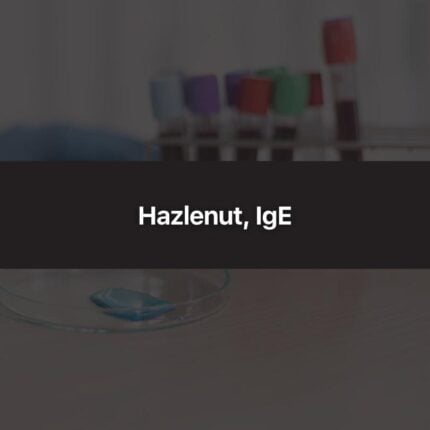Hazlenut, IgE