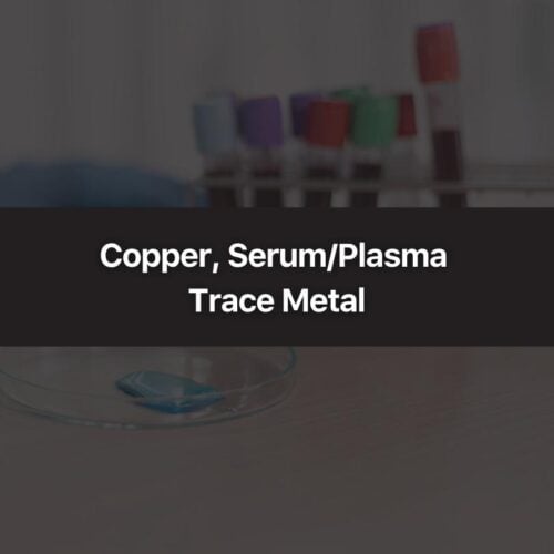 Copper, Serum/Plasma Trace Metal
