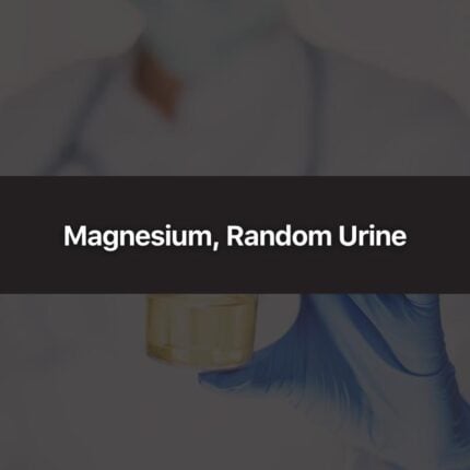 Magnesium, Random Urine
