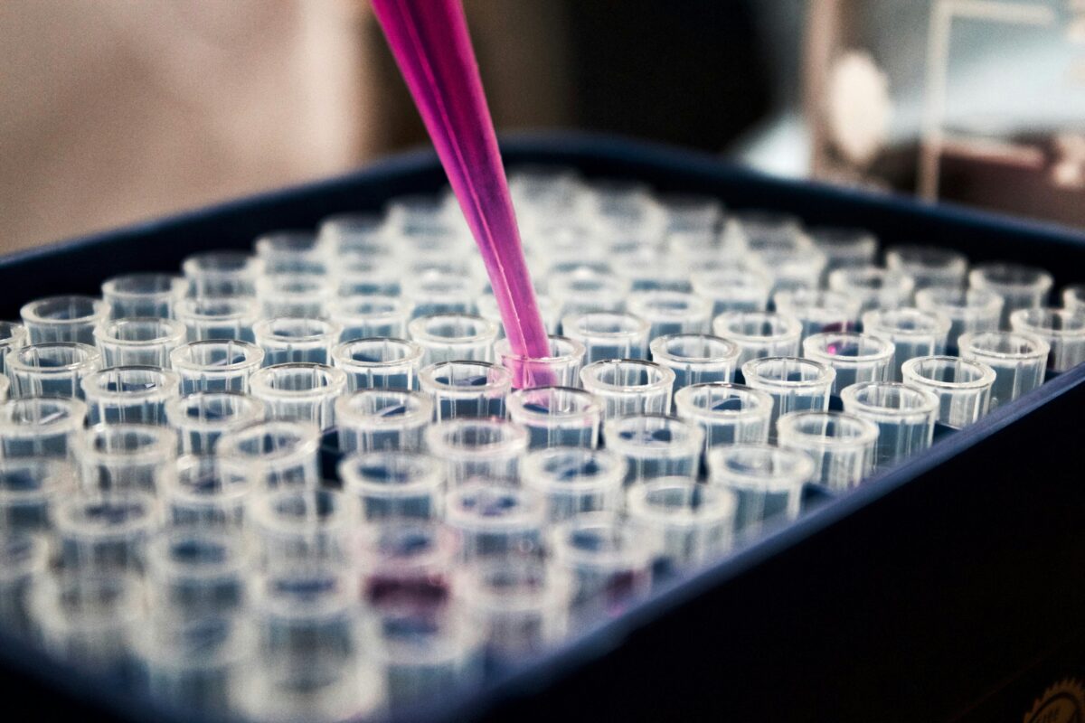 how to get trt lab tests